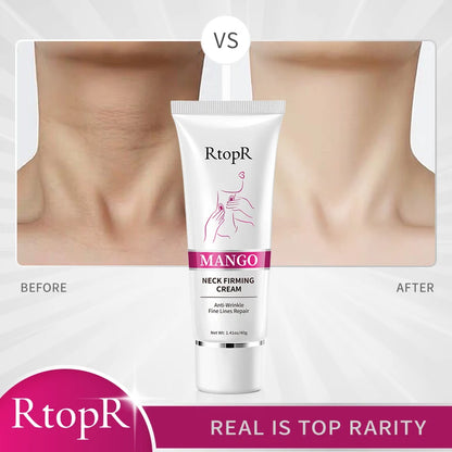 RtopR Neck Firming Wrinkle Remover