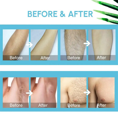 Painless Hair Removal Cream