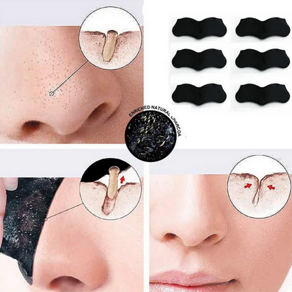 Nose Blackhead Mask Remover