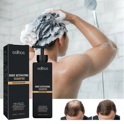 Anti Baldness Fast Deep Clean Follicles Shampoo